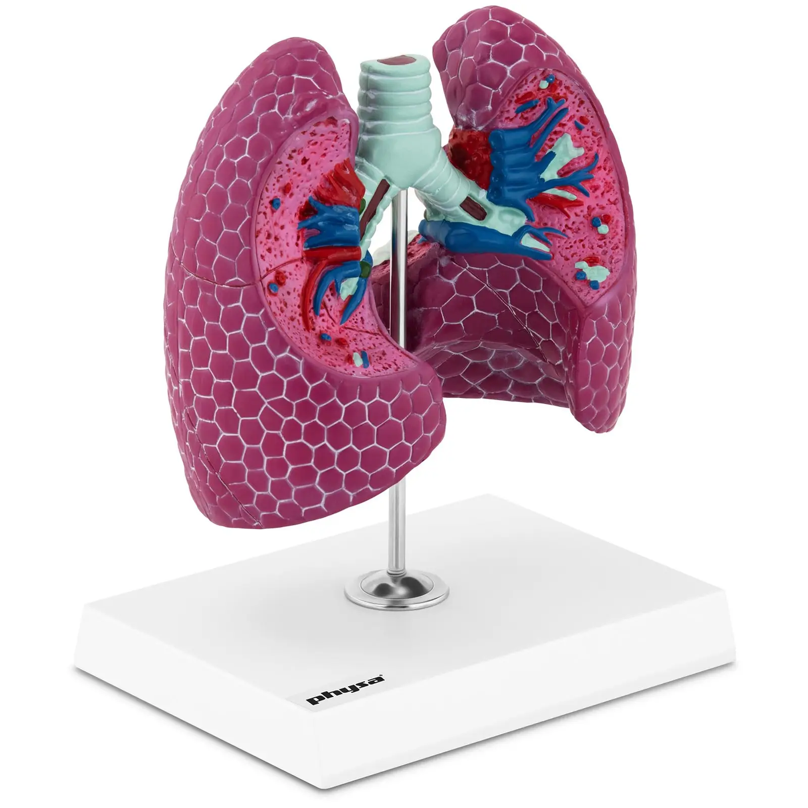 Anatominen malli sairaista keuhkoista